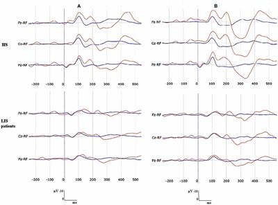 Cognitive Processing in Non-Communicative Patients: What Can Event-Related Potentials Tell Us?